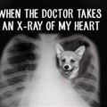 Xray Of My Heart